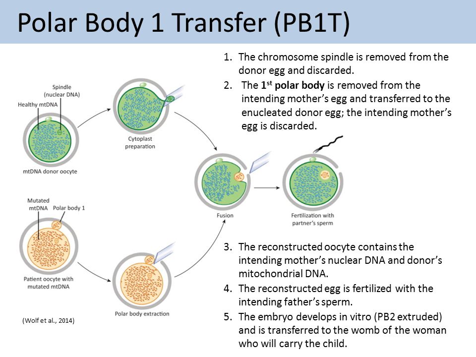 Polar Body Transfer (PBT)
