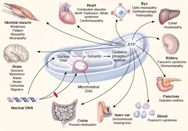 mitochondrial disease