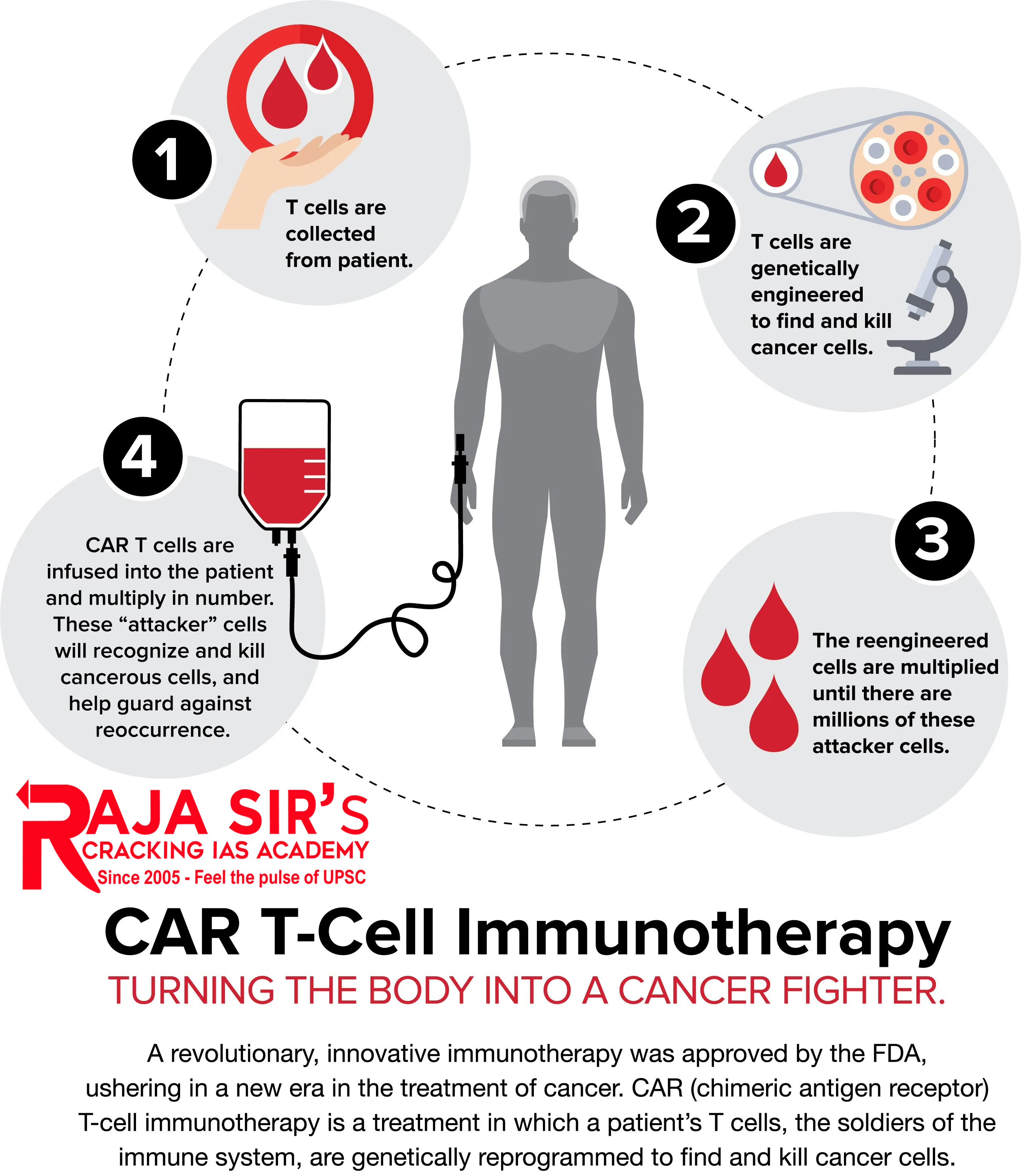 CAR T-Cell Therapy