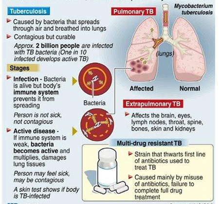 tuberculosis info facts