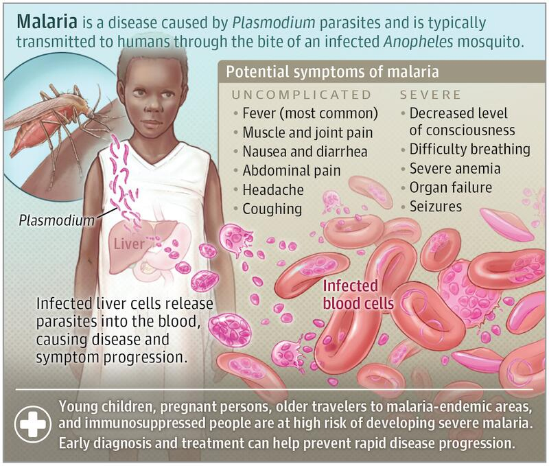Malaria