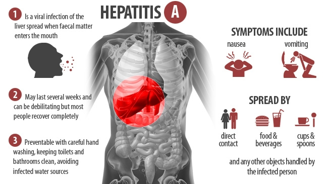Hepatitis A